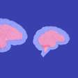 O mistério sobre por que cérebros humanos estão encolhendo