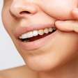 Quanto mais brancos mais saudáveis os dentes? Existe uma coloração considerada ideal?