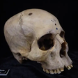 Crânio encontrado no Egito mostra tentativa de tratamento de câncer há 4 mil anos