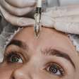 Intervalo ideal para retoques de botox: o que dizem os especialistas