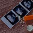 Na Atualidade: Como a Lei do Aborto pode cair no Enem?
