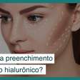 Exposição solar afeta o preenchimento de ácido hialurônico?