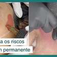 Conheça os riscos de se fazer um blush permanente