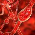 Nem todo aneurisma é cerebral; conheça outros tipos