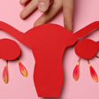 Dr. Igor Padovesi lança livro para desmistificar a menopausa