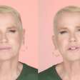 Xuxa revela que fez implante capilar e detalha tratamento: 'Me incomodava bastante'