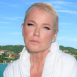 Xuxa Meneghel passa por transplante capilar e compartilha Experiência