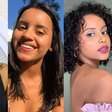 Antes e depois de Gleici Damasceno: campeã do 'BBB' mudou completamente após plástica no nariz e 'entrou em desespero' com resultado. Veja 30 fotos!