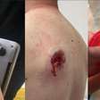 Notebook na mochila salva motociclista de tiro nas costas durante assalto