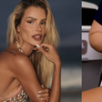 Yasmin Brunet compartilha qual tratamento está fazendo para o lipedema; conheça!