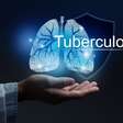 5 sintomas de alerta para a tuberculose