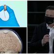 Backup de memórias, cura para doenças e até telepatia: o que promete a Neuralink de Elon Musk e o que ela já conseguiu