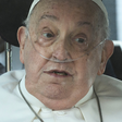 'Morrer em paz': o desabafo do médico de Papa Francisco sobre estado de saúde crítico do pontífice