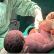 Bebê 'gigante' surpreende ao nascer com mais de 6 quilos em Minas Gerais