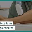 Depilação a laser para adolescentes: quando é indicado?