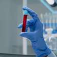 Hemofilia: mitos sobre doença que afeta a coagulação do sangue