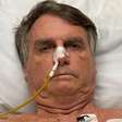 Bolsonaro completa uma semana internado após cirurgia de 12 horas; não há previsão de alta