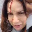 Isadora Ribeiro aparece com a testa sangrando em vídeo: 'Detalhes'