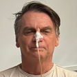 Internado há duas semanas, Bolsonaro começa a ingerir água, chá e gelatina