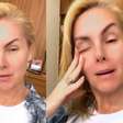 Após crítica sobre sua fala, Ana Hickmann revela diagnóstico de TDAH e rebate seguidora