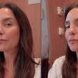 Susto? Ivete Sangalo faz alerta ao surgir no hospital: 'Sério'