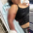Avó atacada por pitbull isolou neta bebê e precisou trancar porta para evitar mordidas