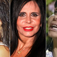 Antes e depois: 5 famosos que fizeram cirurgia plástica e mudaram drasticamente