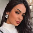 Ex-BBB Larissa Santos detalha sua recuperação após levar 14 pontos em acidente: 'Evoluindo'