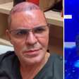 Eduardo Costa faz show careca: 'Não estou preocupado com minha aparência'