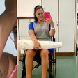 Mulher fica paraplégica após infecção causada por furúnculo: 'Chorei por ter conseguido ficar viva'