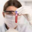 Por que temos tipos sanguíneos diferentes? A surpreendente história por trás do sangue humano