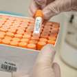 Estudo revela possível ligação entre bactéria intestinal na infância e aumento de câncer colorretal em jovens