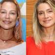 Luana Piovani, Ana Paula Siebert, Poliana Rocha e Leticia Spiller já fizeram: médico alerta para risco de cirurgia realizada por famosas: 'Alterações...'