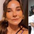 Atriz de A Viagem revela acidente na Record que a deixou com queimaduras