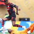 Paciente cita Flamengo x Chelsea em meio à cirurgia cerebral