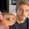 É grave? Namorado de Juliette recebe alta, mas segue com pele e olhos amarelados