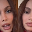 Sem 'pé na cova', sem cara 'desfigurada': Anitta fala pela 1ª vez sobre nova plástica no rosto. 'Eu sempre fiz, mas'