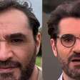 Ex-calvo, apresentador exibe resultado do implante e abandona o 'shape' musculoso