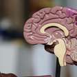 Mulher morre após aneurisma cerebral romper durante orgasmo