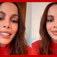 Anitta fala pela primeira vez sobre a repercussão das novas plásticas