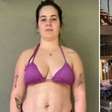 'Mommy Makeover': Médico explica 'combo' de cirurgias feitas por Viih Tube para eliminar 15 kg