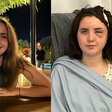 Jovem descobre tumor cerebral após achar que estava com insolação