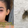 Jovem vai parar no médico após mosca entrar no olho: 'Desesperada'