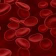 Mielodisplasia: doença silenciosa pode evoluir para leucemia