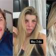O que ex-Bbb Íris Stefanelli fez no rosto? Veja antes e depois