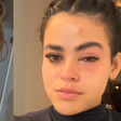 'Mosquinha parece ser inofensiva, mas não é', diz jovem que viralizou após infecção ocular