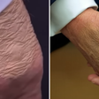 Antes de diagnóstico, Trump foi flagrado com mão maquiada e pés inchados