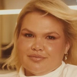 Thais Carla revela problema que está enfrentando após cirurgia bariátrica