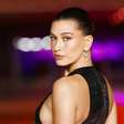 O que é dermatite perioral? Hailey Bieber fala sobre doença e como lida com uma crise: skincare minimalista é sua aposta!