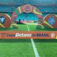 Confira as escalações oficiais de Bahia x Retrô, pela Copa do Brasil